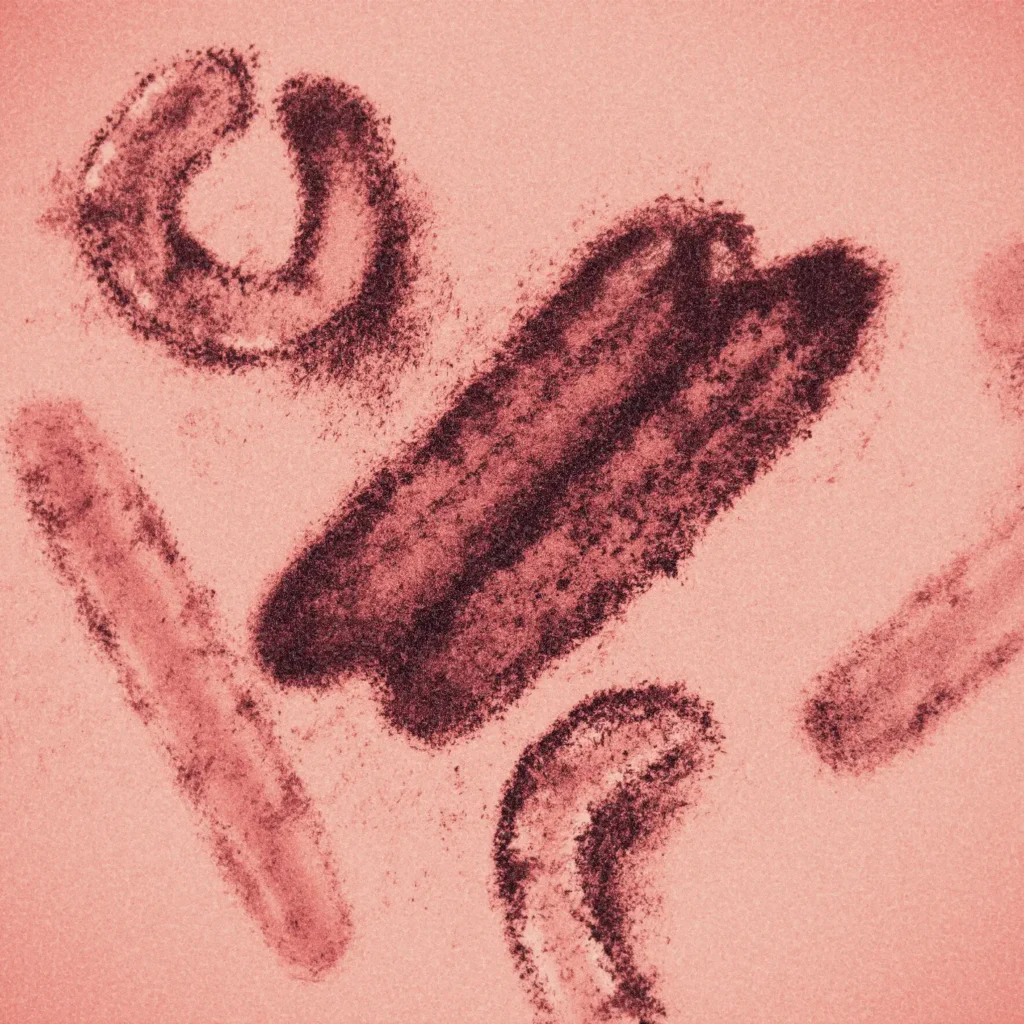 Images of the Marburg fever virus